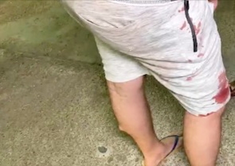 Motorista de app é esfaqueado ao ajudar parceiro durante assalto em Manaus