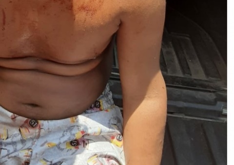 Após ser torturado, jovem é salvo da morte em tribunal do crime em Manaus