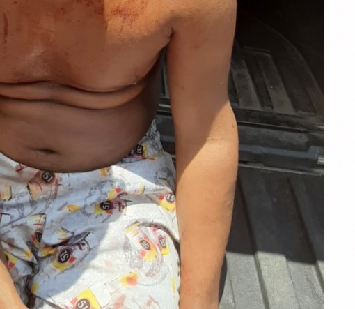 Após ser torturado, jovem é salvo da morte em tribunal do crime em Manaus