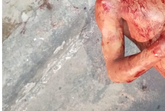 Homem tem roupas arrancadas durante sessão de espancamento em Manaus