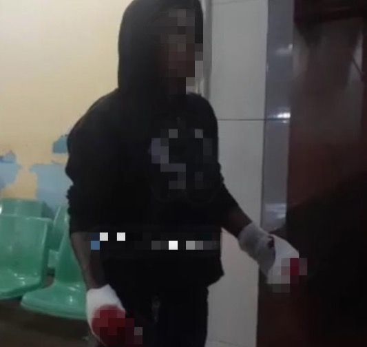 Jovem quase perde as mãos ao ser baleado no Amazonas