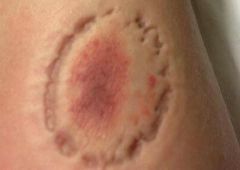 Homem morde e espanca esposa que defendeu cão da família