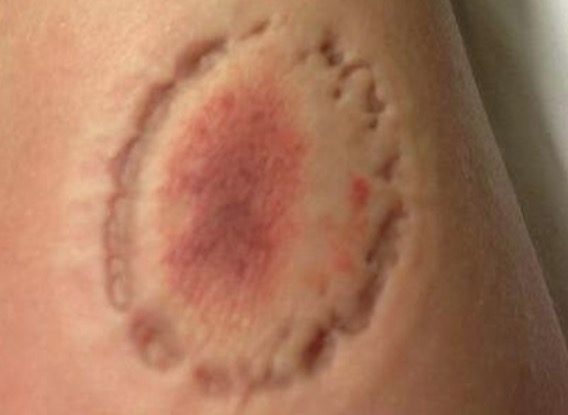 Homem morde e espanca esposa que defendeu cão da família