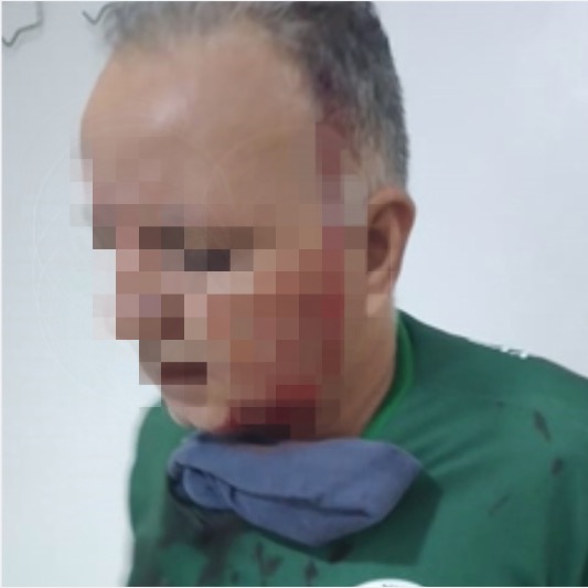 Vídeo: cobrador é esfaqueado dentro de ônibus em Manaus 