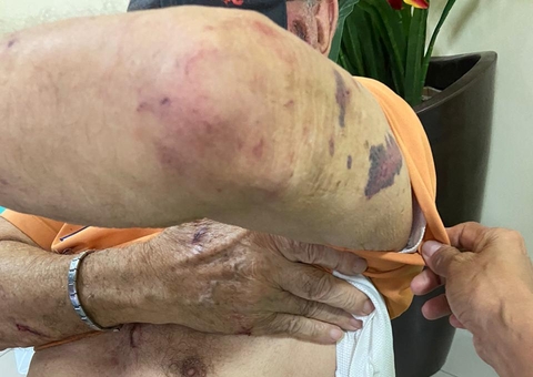 Vídeo: Idoso é violentamente espancado e mordido por assaltante em Manaus
