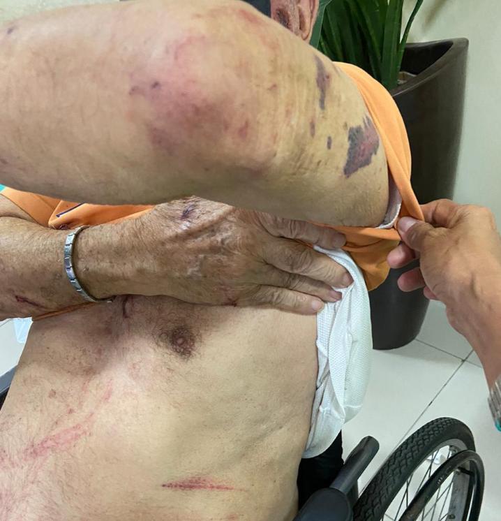 Vídeo: Idoso é violentamente espancado e mordido por assaltante em Manaus