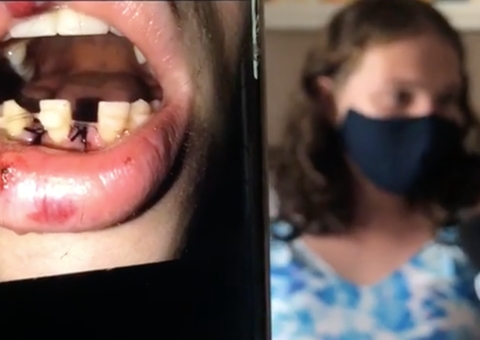 Transexual é agredida a socos por companheiro em Manaus