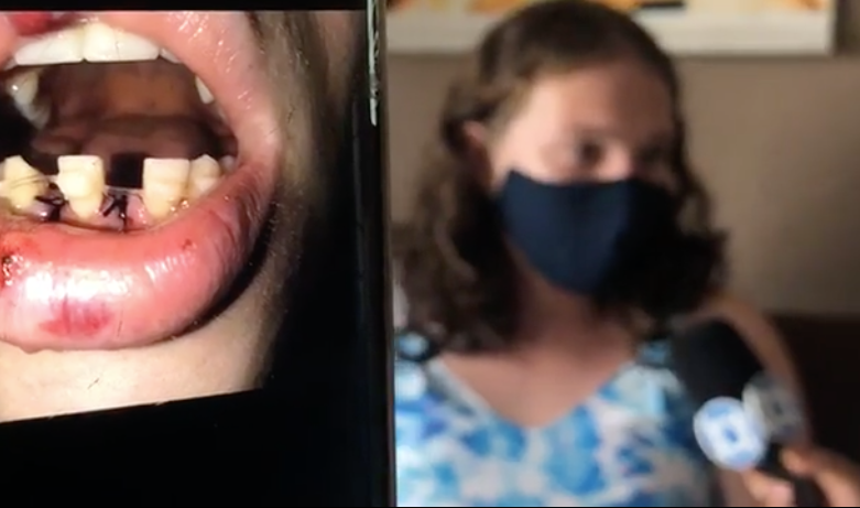 Transexual é agredida a socos por companheiro em Manaus