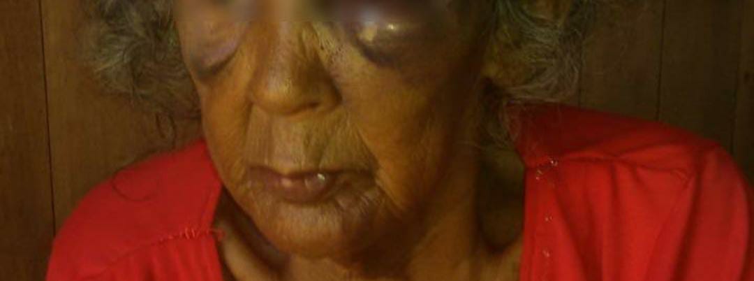 Grupo invade casa e espanca idosa de 76 anos no Amazonas 