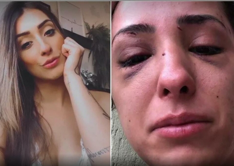 Modelo fica com rosto deformado ao ser espancada por terminar namoro