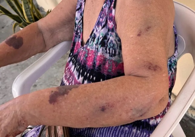 Idosa de 87 anos é espancada com cabo de vassoura pela neta em Manaus
