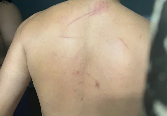 Irmãos são presos e acusam PMs de tortura em Manaus