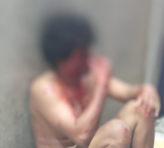 Suspeito de assalto é espancado pela população no Petrópolis