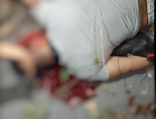 Motociclista sofre grave acidente ao tentar desviar de galho no Puraquequara