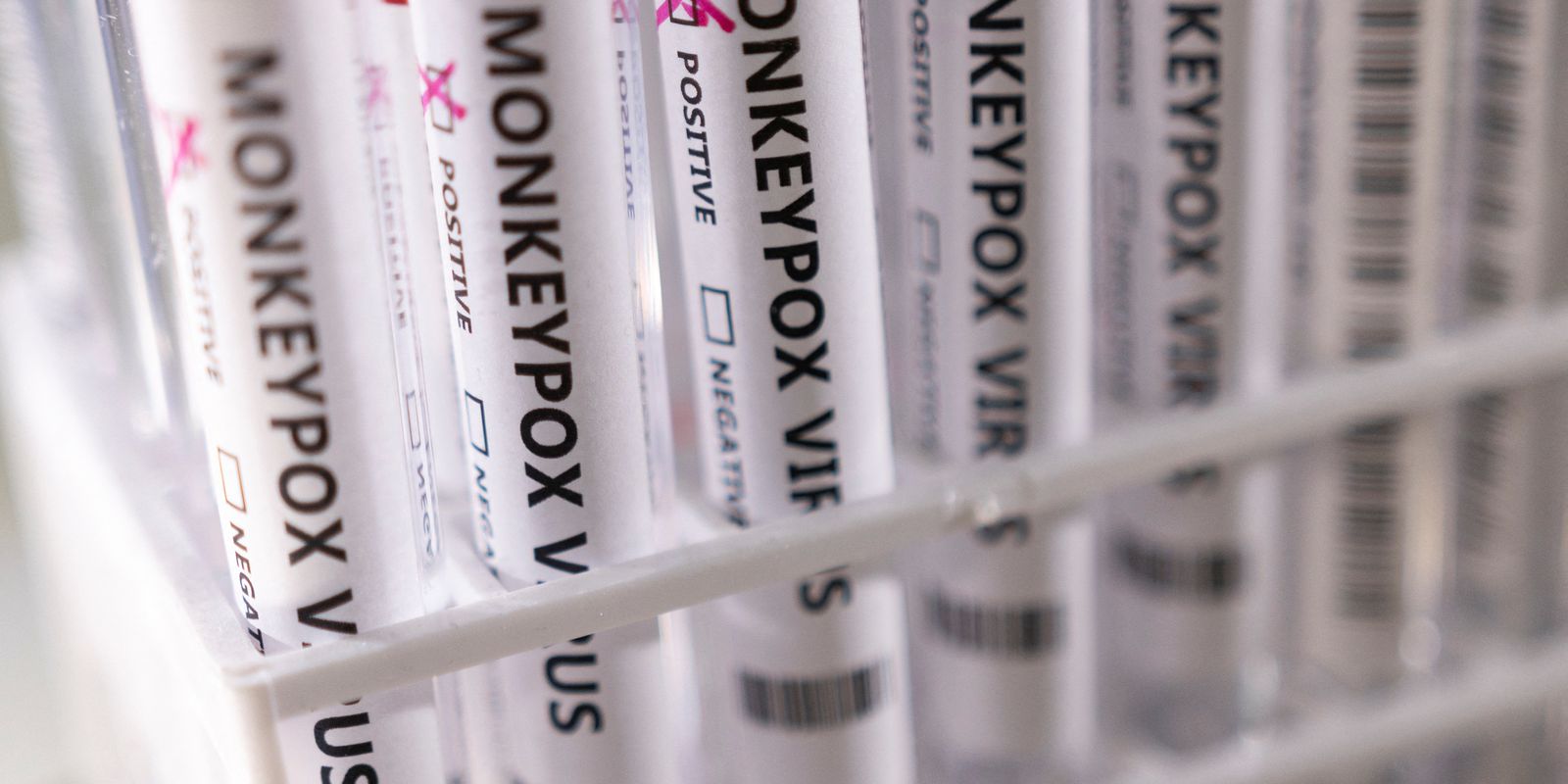 Mais 7 casos de varíola dos macacos são confirmados no Amazonas