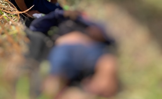 Pernas de motociclista ficam dilaceradas durante acidente em Manacapuru