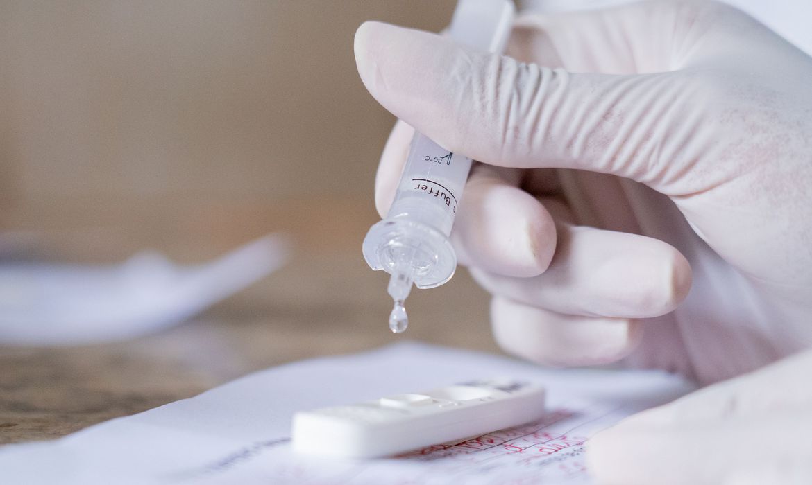 Amazonas registra nas últimas 24 horas 653 novos casos de Covid