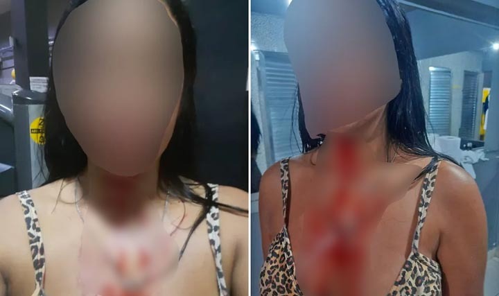 Mulher é brutalmente agredida em academia ao conversar com amigo sobre política