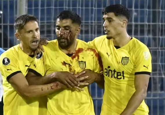 Libertadores: Conmebol abrirá processos sobre pedrada e racismo