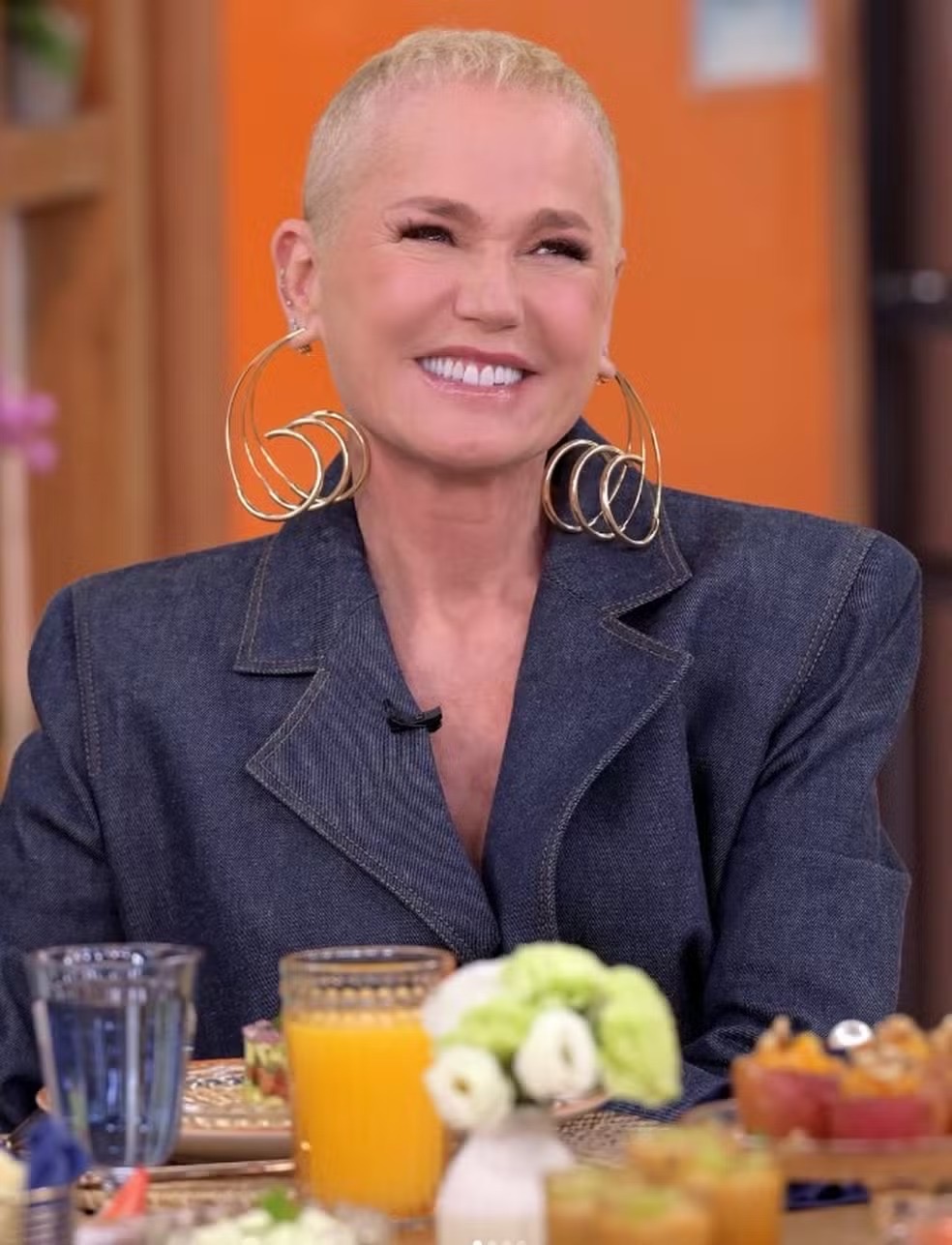 Xuxa revela que tem calvície e passou por transplante capilar