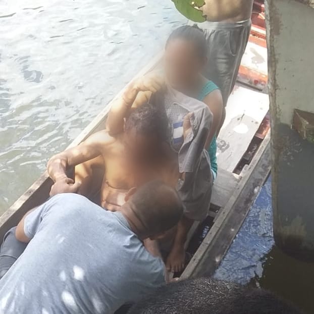 Idoso tem ossos do rosto amassados e fica sem olho durante ataque de onça