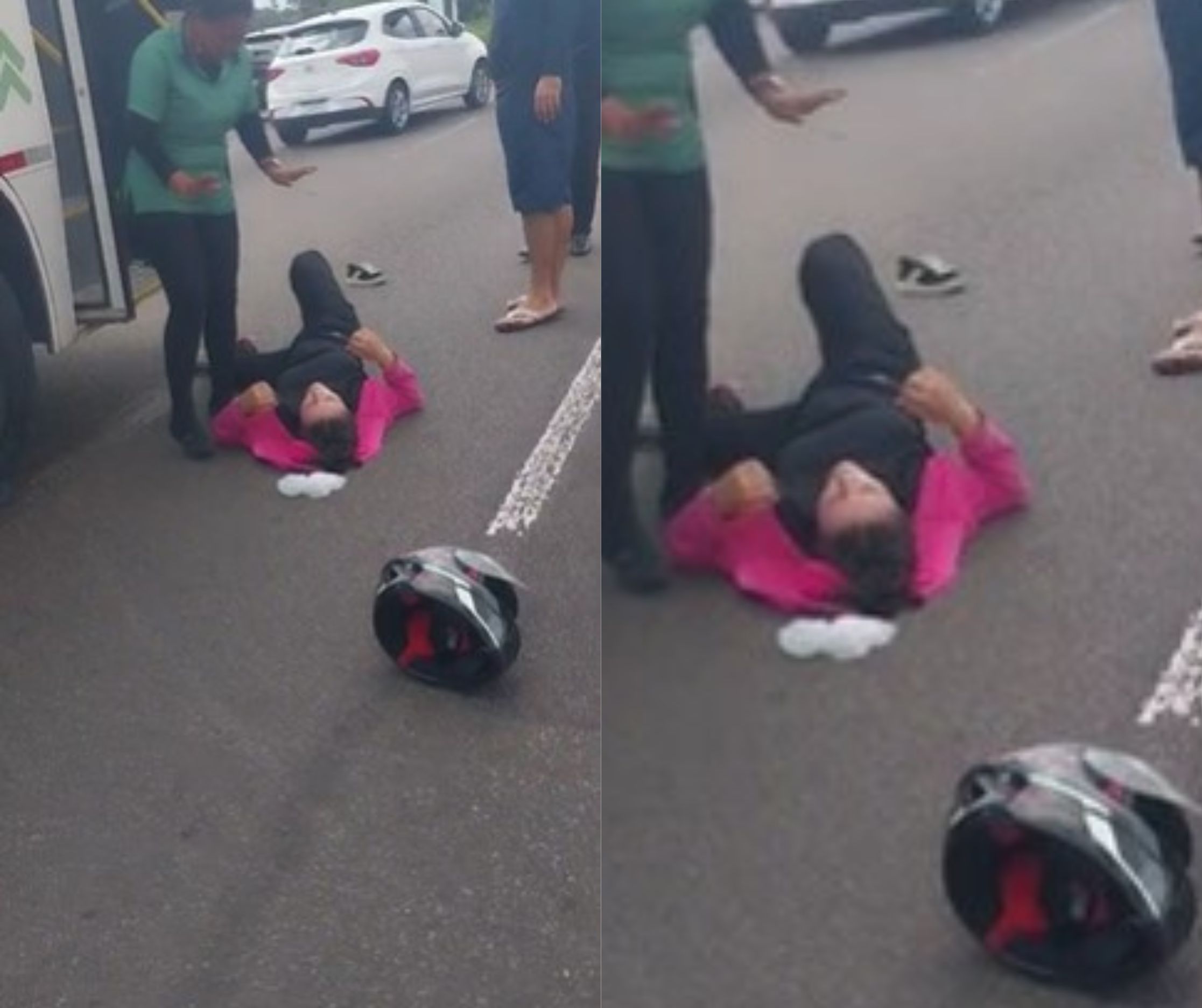 Mulher sofre fratura exposta em acidente de moto na Av. Torquato Tapajós