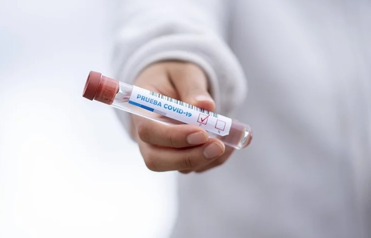 Amazonas registra 47 novos casos de Covid nesta quarta-feira