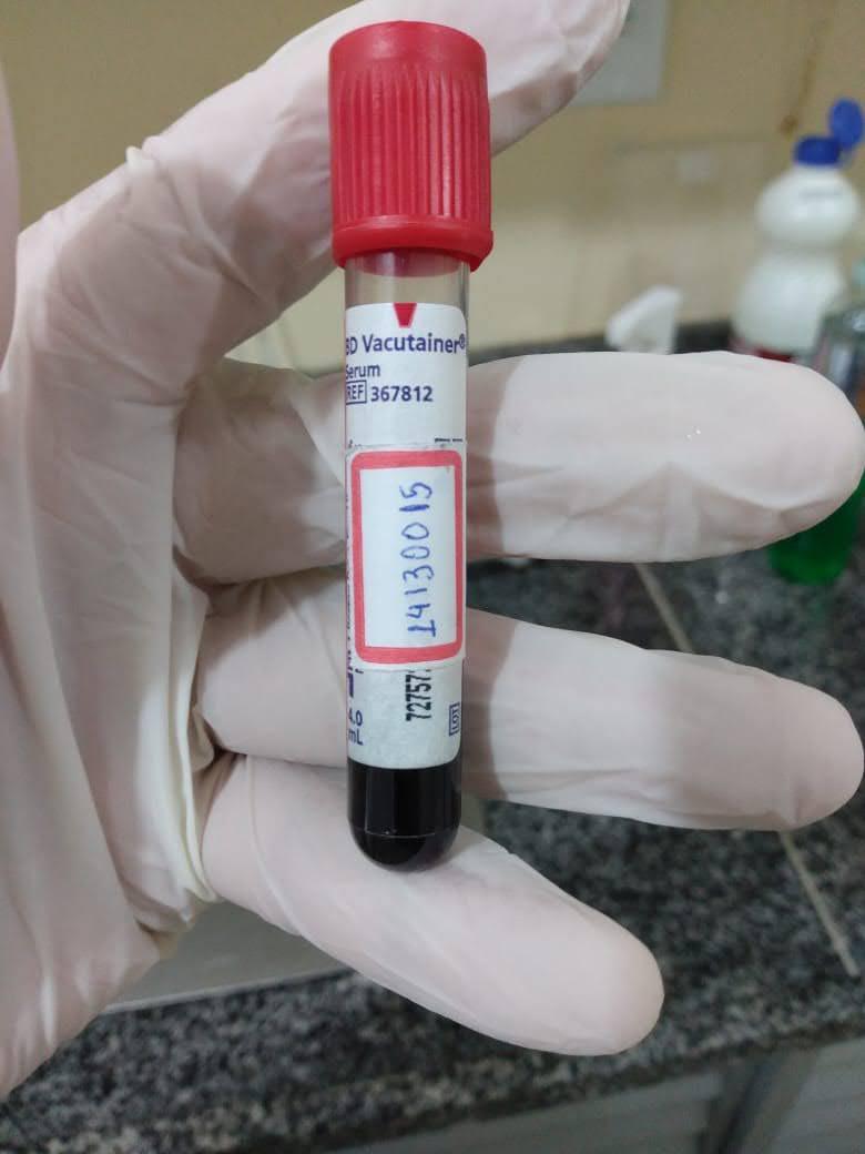 Pesquisadores do Amazonas desenvolvem app que ajuda no diagnóstico de doenças febris