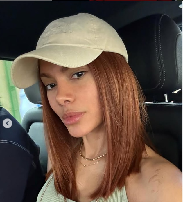 Equipe de Anitta nega ter detalhado procedimentos estéticos da cantora 