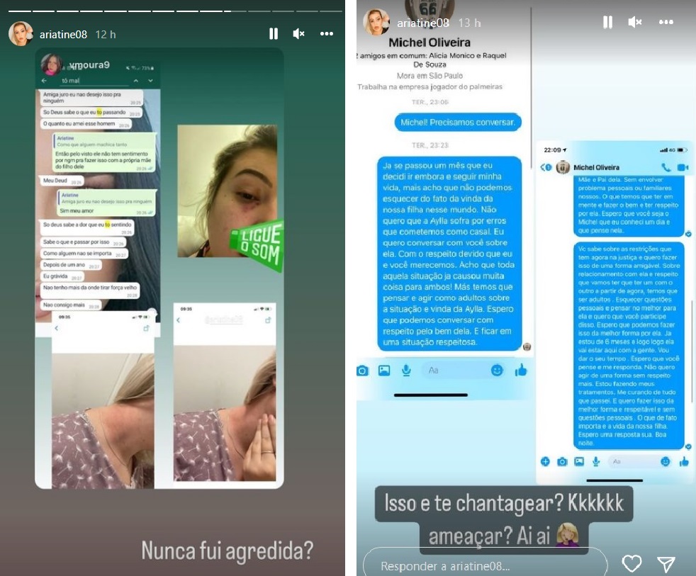 Grávida, ex de Michel do Palmeiras mostra fotos de hematomas, áudios e prints após jogador negar agressão