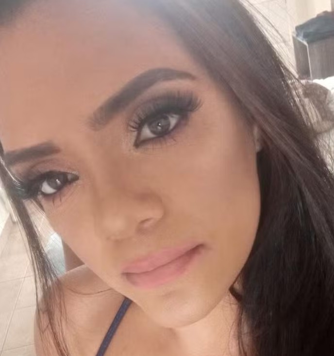 Mulher perde fala, visão e movimentos após passar por procedimento estético em  SP