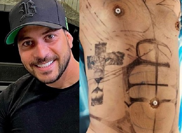 Ex-BBB Caio Afiune faz recauchutagem com lipo lad e fica sarado; veja o resultado