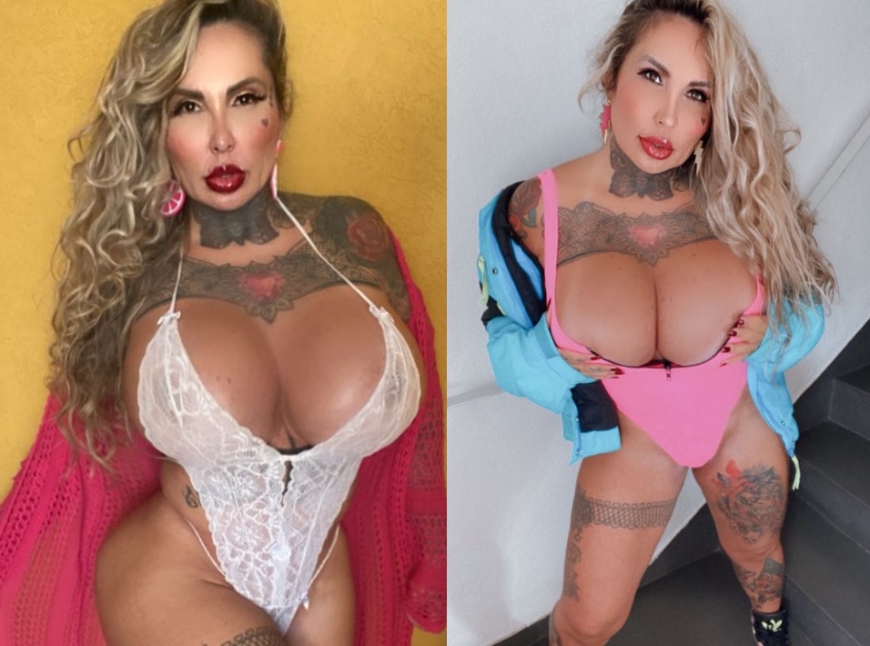 Sabrina Boing Boing retira 6 litros de silicone e relata depressão 