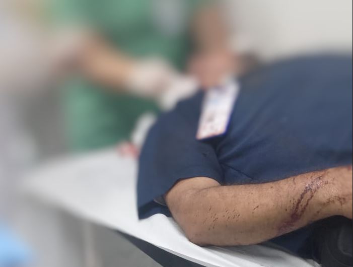 Motorista é esfaqueado durante assalto a ônibus em Manaus