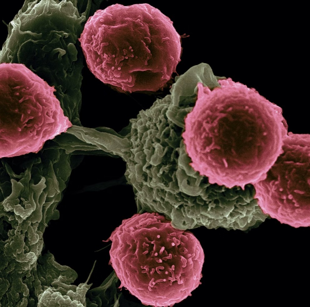 É possível reduzir fatores de risco do câncer? Veja 12 formas de se prevenir