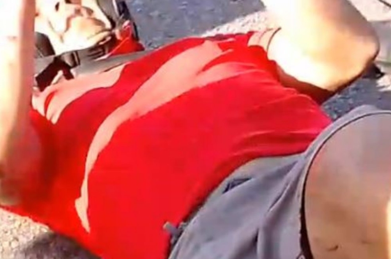 Homem sofre acidente grave e tem perna dilacerada em Manaus