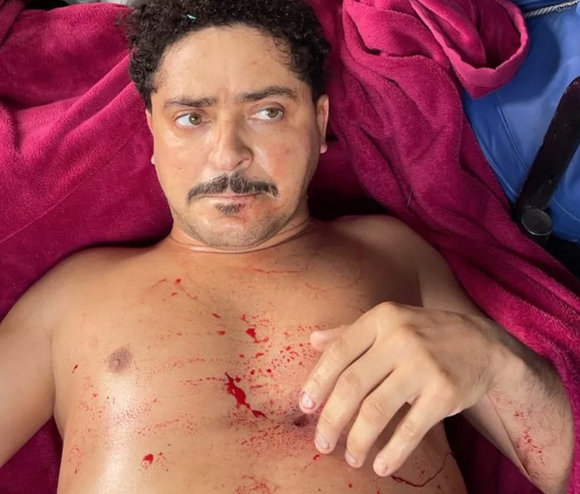 Ecko, chefe da maior milícia do Rio de Janeiro, morre após ser baleado 