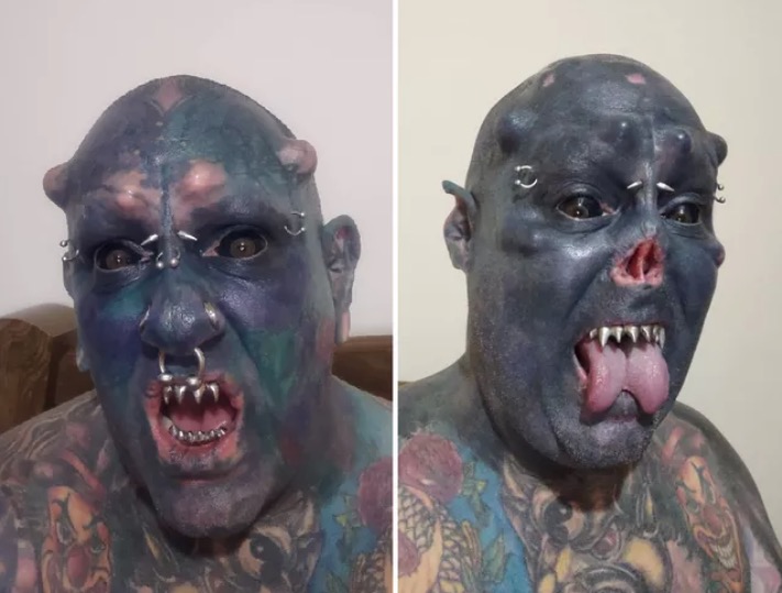 'Caveira' corta o nariz e choca com transformação; Veja antes e depois