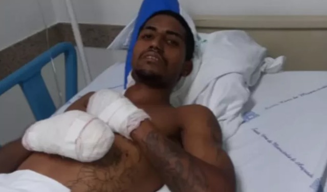 Ciclista em Araçatuba não viu bomba e entrou em desespero ao olhar para pernas 