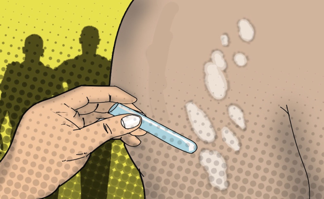 Amazonas adere à campanha global de combate à hanseníase