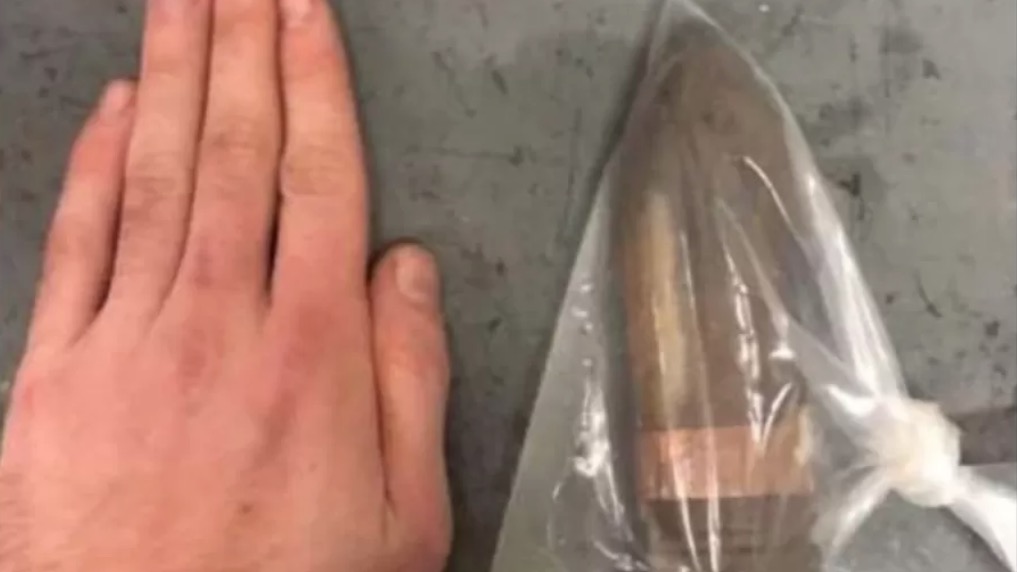 Homem tem projétil de canhão enfiado no ânus e hospital aciona equipe antibomba