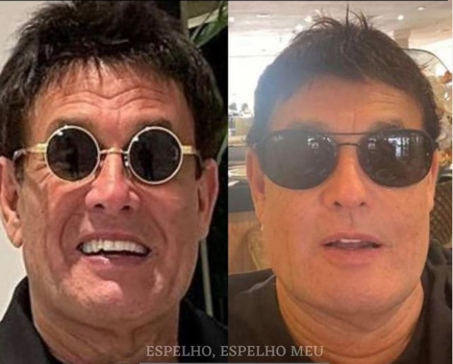 Sérgio Mallandro faz harmonização facial e surpreende com resultado