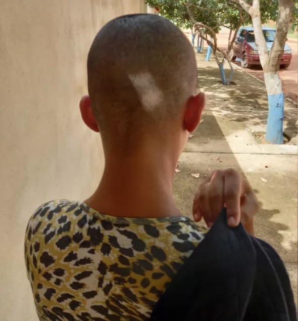 Adolescente é agredida com cabo e tem cabeça raspada à força pelo namorado