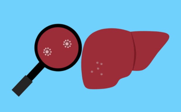 Primeiro caso de hepatite misteriosa que atinge crianças é registrado na Argentina 