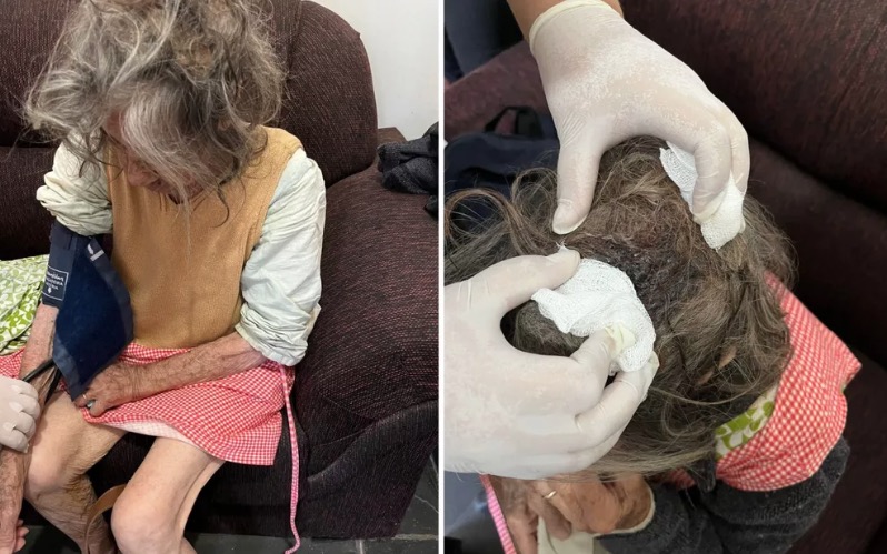 Idosa é encontrada desnutrida e com larvas na cabeça; filho foi preso