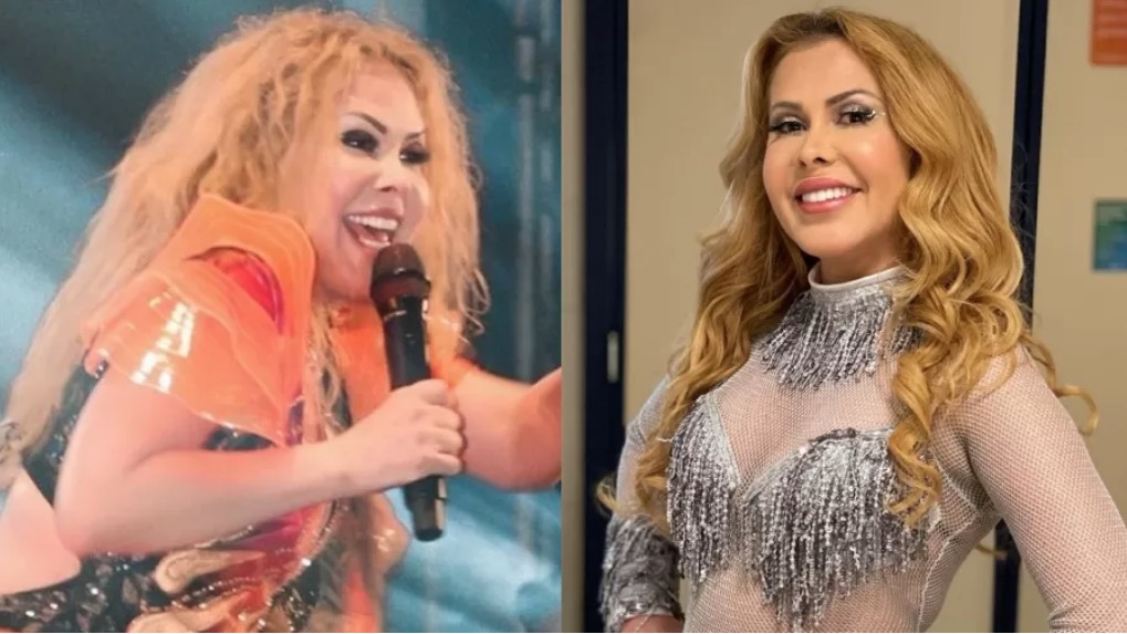 Médica explica que inchaço no rosto de Joelma é combinação de Covid e corticoides 
