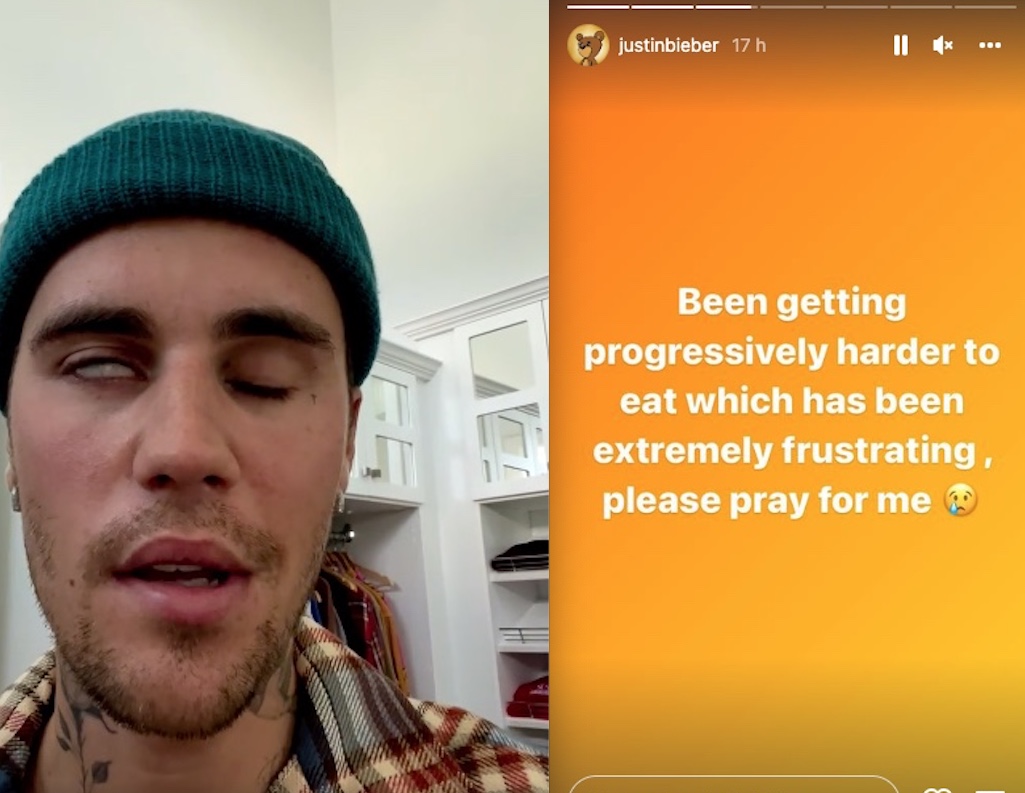 Justin Bieber pede orações após revelar síndrome rara: 'cada vez mais difícil comer'