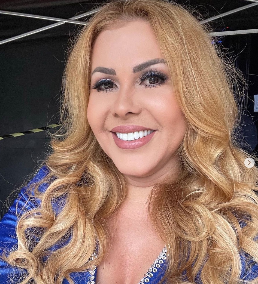 Joelma recebe alta do hospital após inchaço no rosto