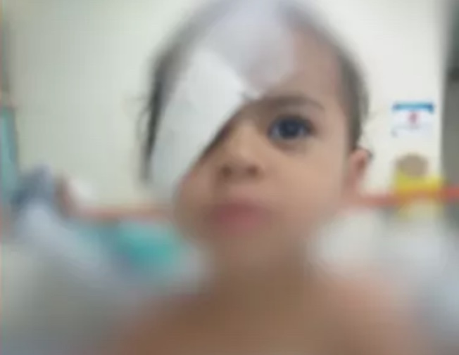Menina de 2 anos que grudou olho com cola passa por cirurgia