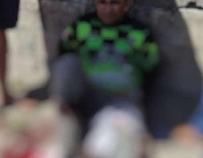 Mototaxista tem perna dilacerada em grave acidente com carro em Manaus